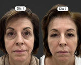 Cepillo Facial Para Masajes de Drenaje Linfatico